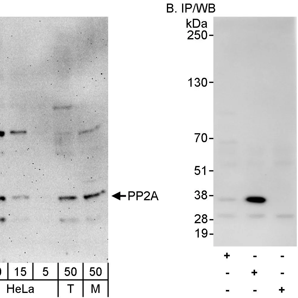 Rabbit anti-PP2A Antibody, Affinity Purified