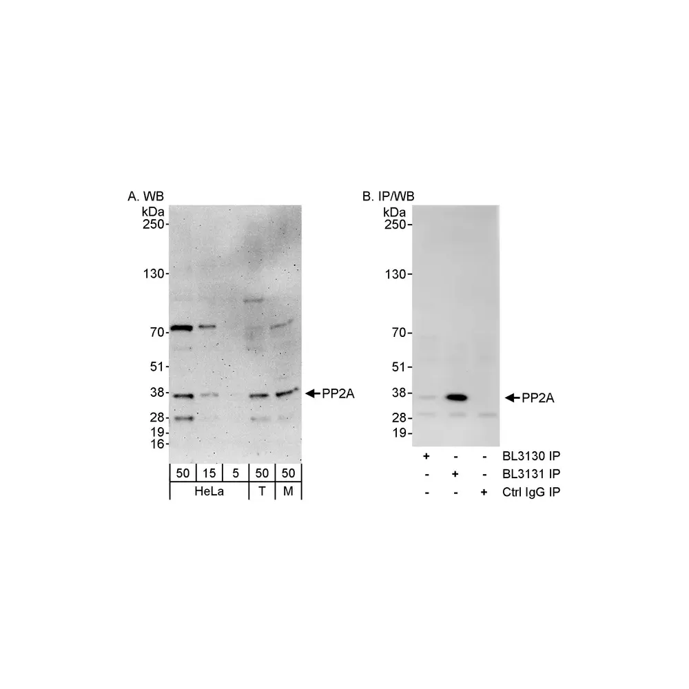 Rabbit anti-PP2A Antibody, Affinity Purified