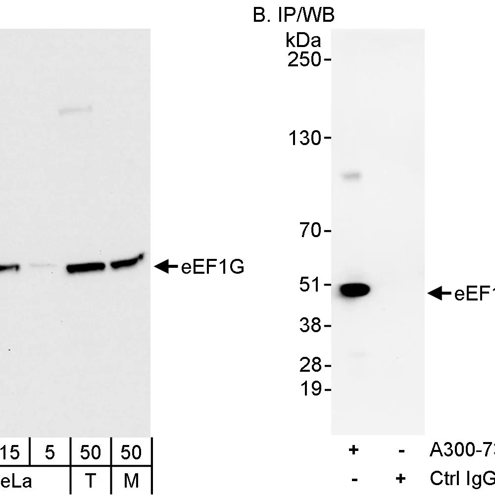 Rabbit anti-eEF1G Antibody, Affinity Purified