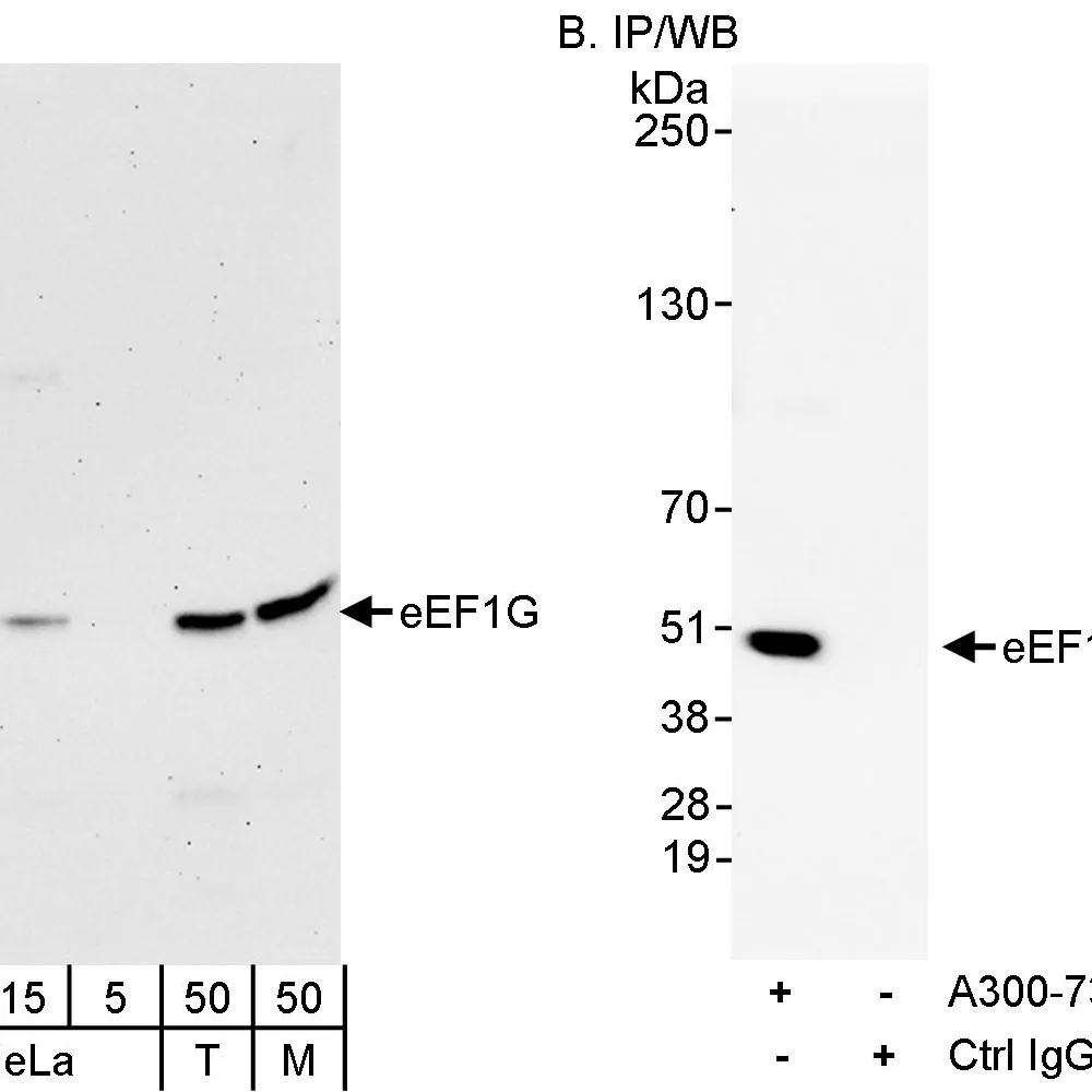 Rabbit anti-eEF1G Antibody, Affinity Purified