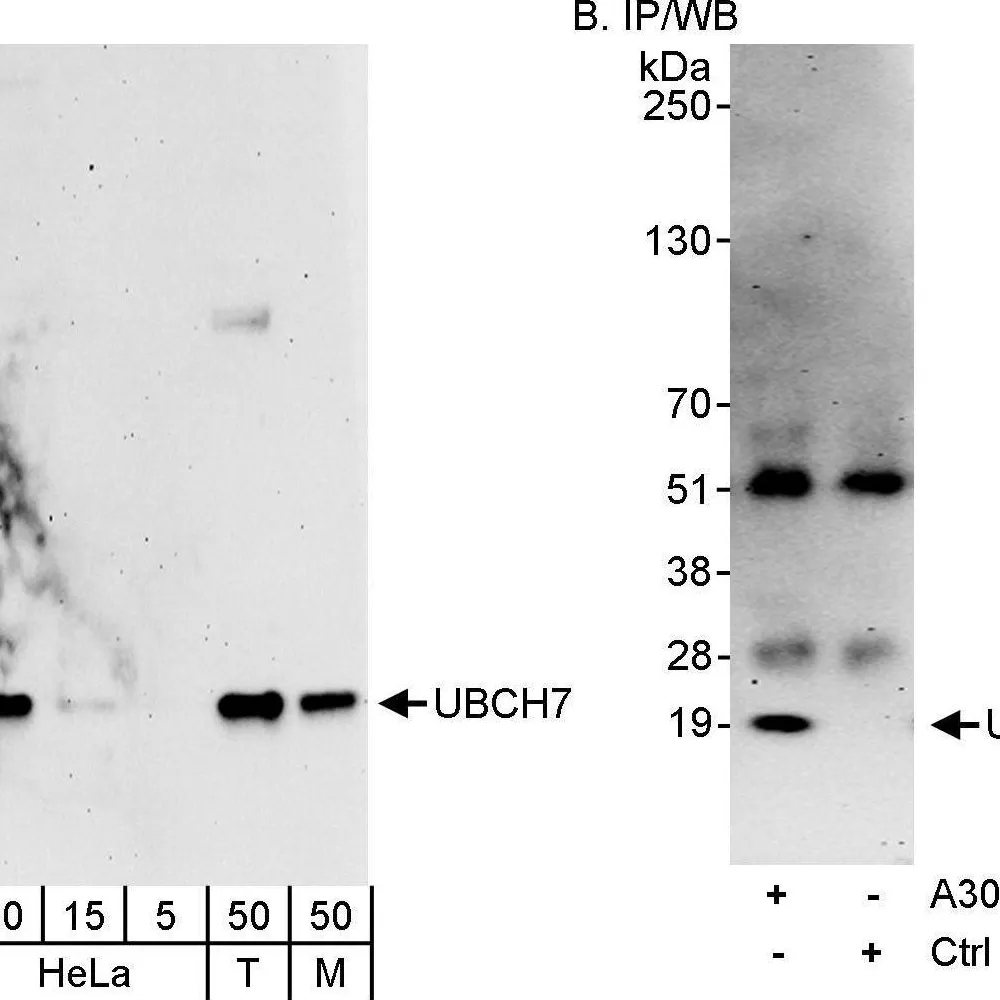 Rabbit anti-UBCH7 Antibody, Affinity Purified