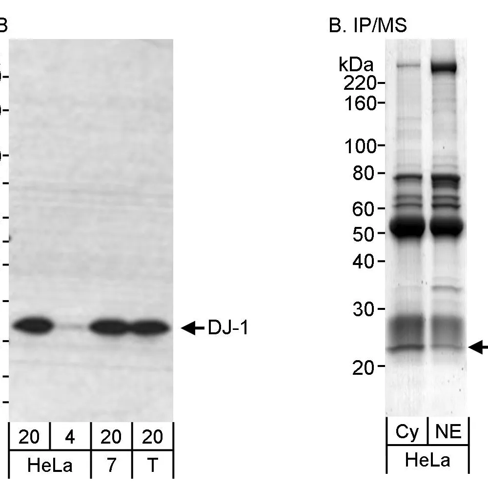 Rabbit anti-DJ-1 Antibody, Affinity Purified