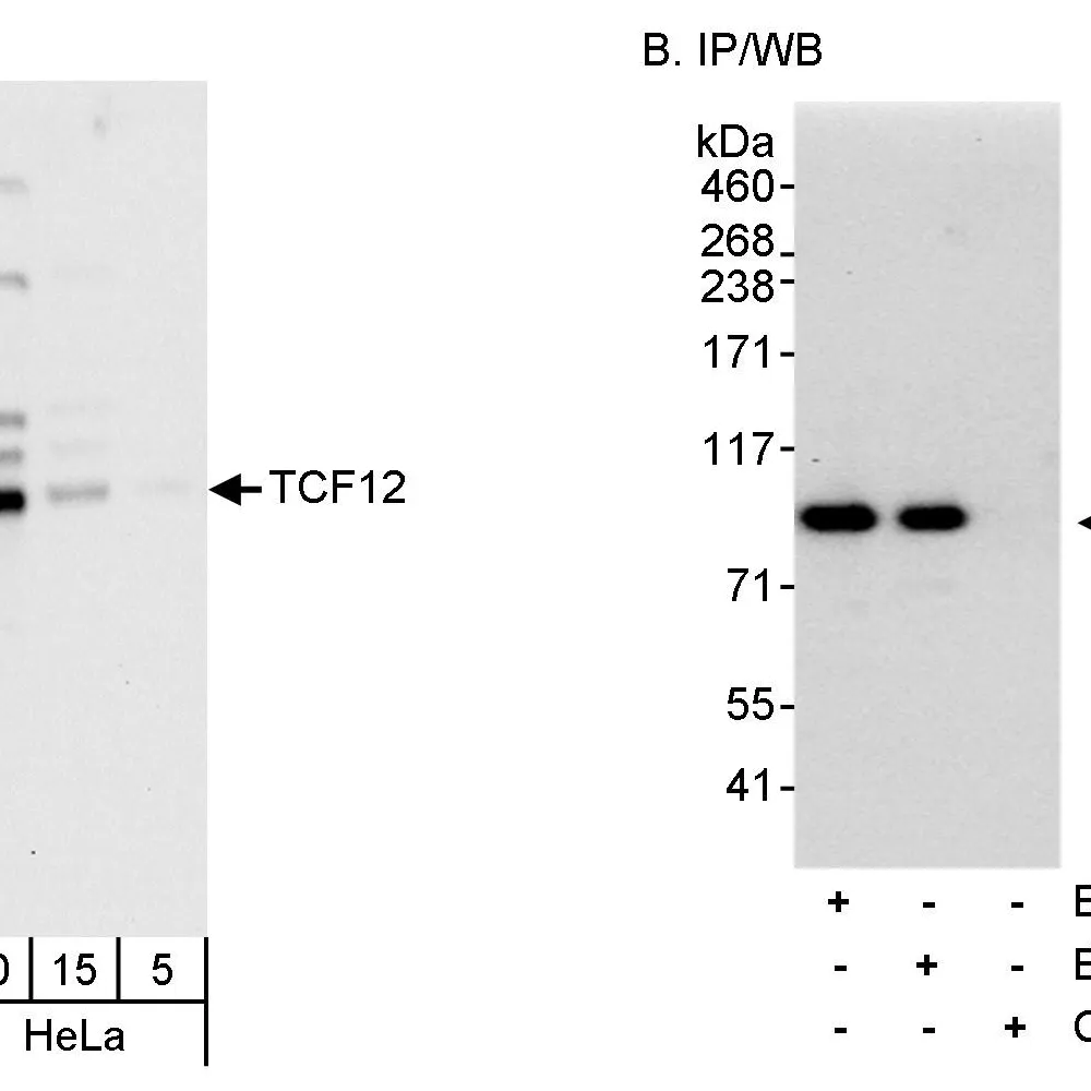 Rabbit anti-TCF12 Antibody, Affinity Purified