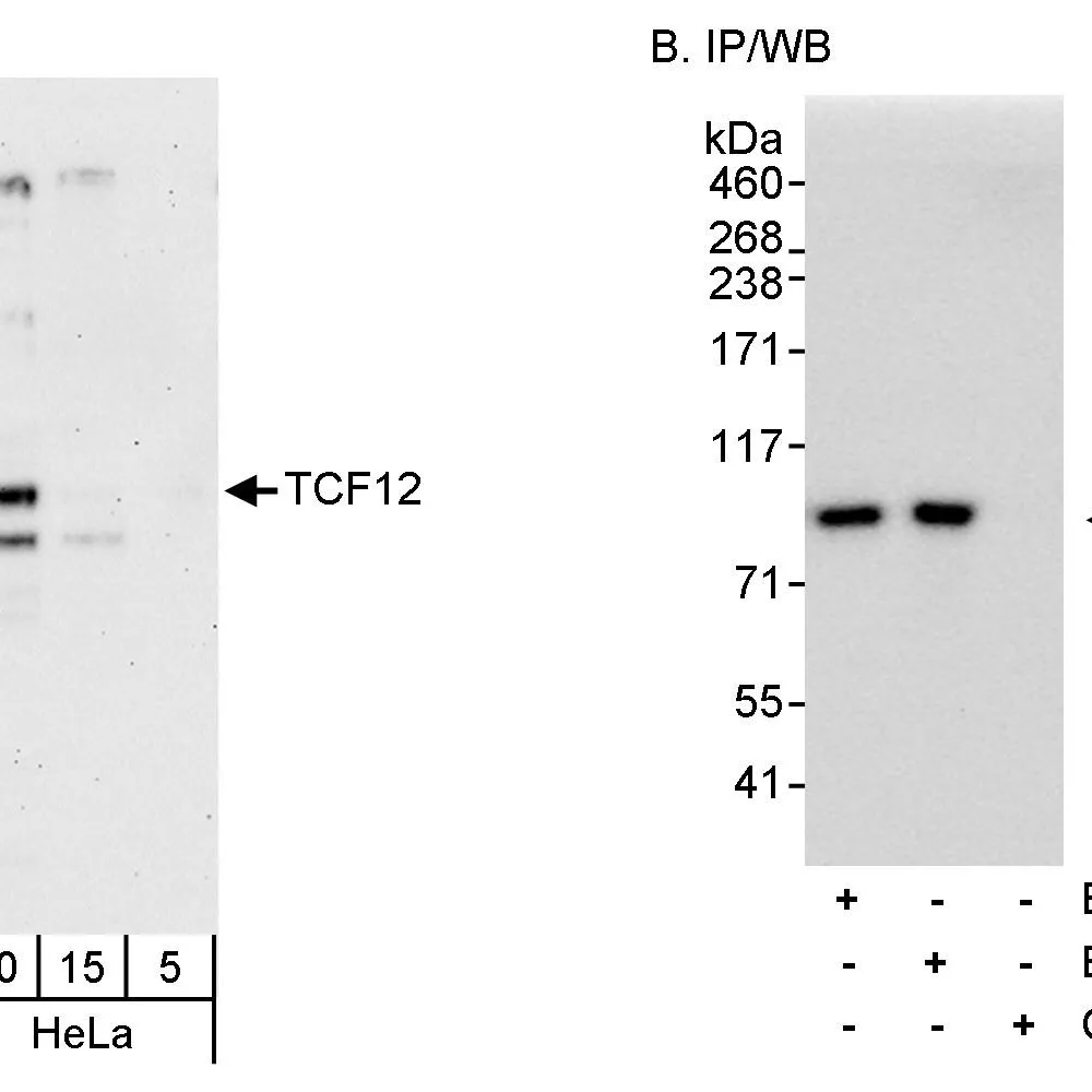 Rabbit anti-TCF12 Antibody, Affinity Purified