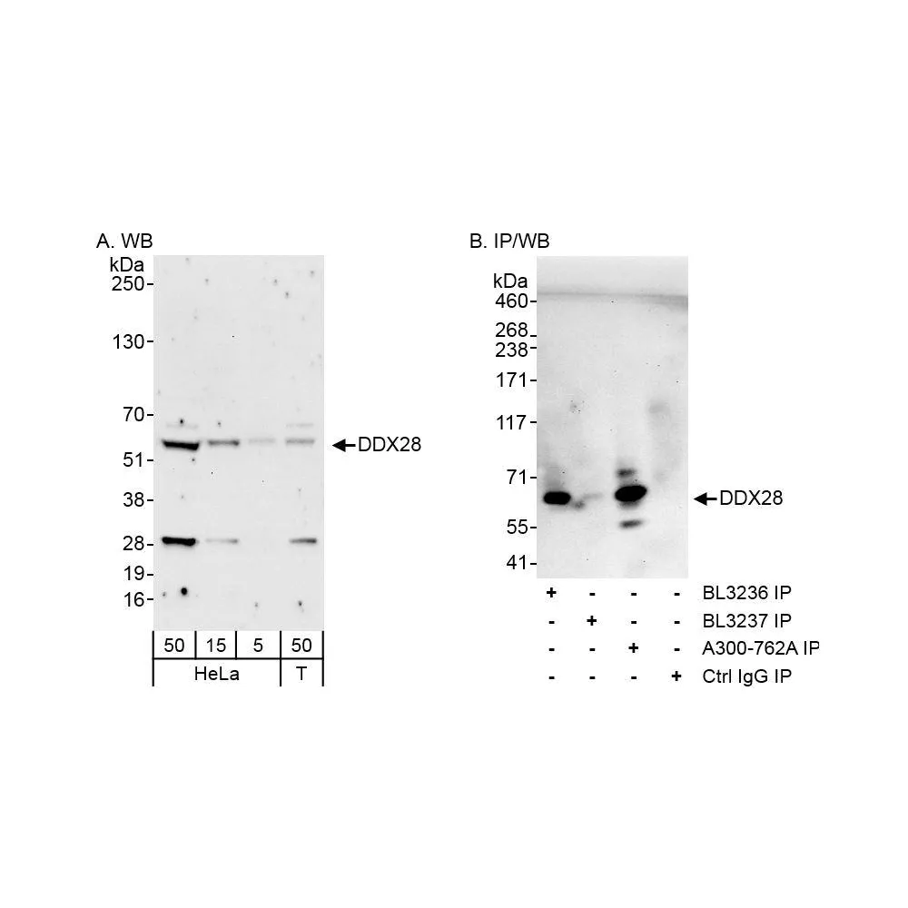 Rabbit anti-DDX28 Antibody, Affinity Purified