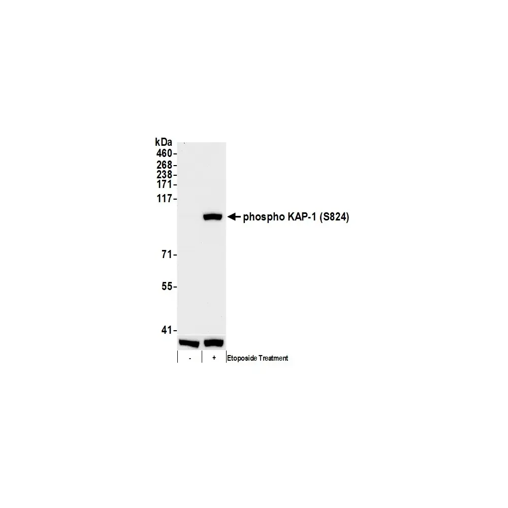 Rabbit anti-Phospho KAP-1 (S824) Antibody, Affinity Purified