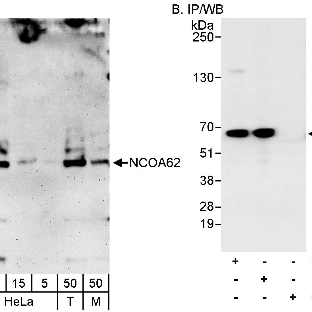 Rabbit anti-NCOA62 Antibody, Affinity Purified
