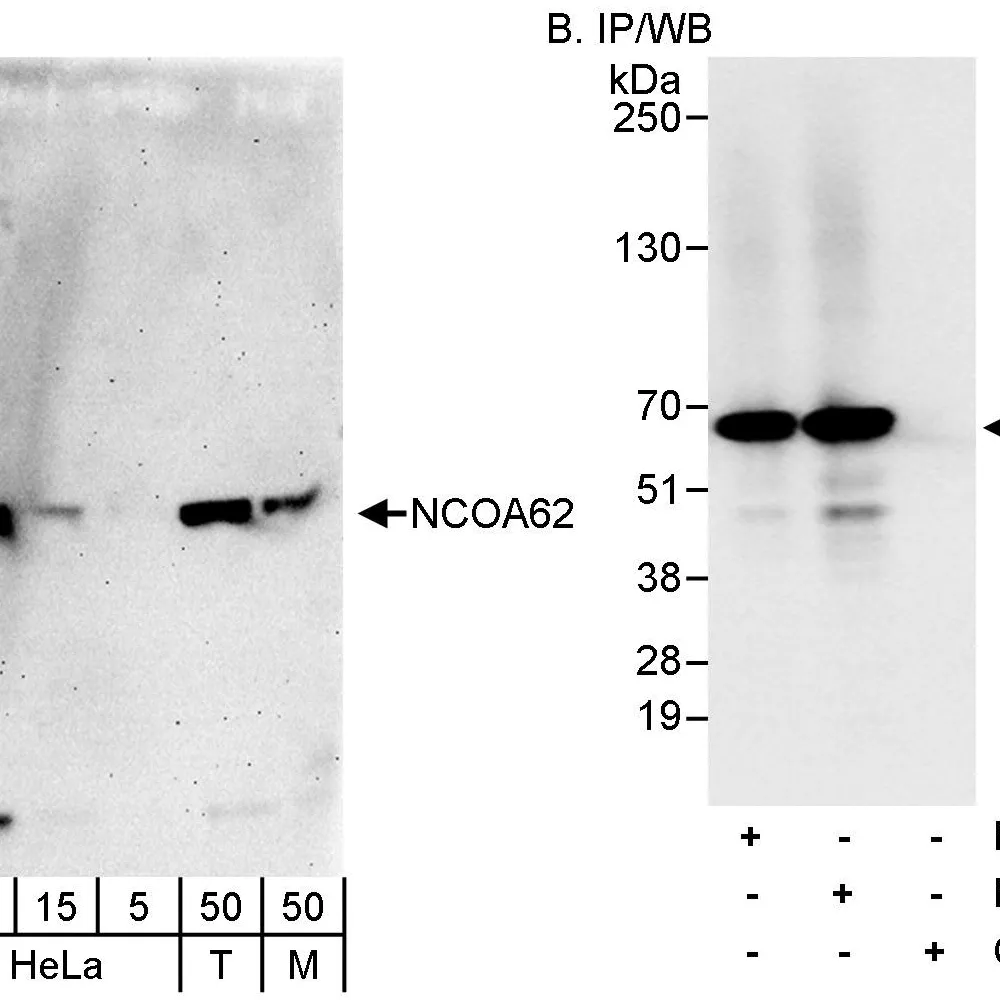 Rabbit anti-NCOA62 Antibody, Affinity Purified