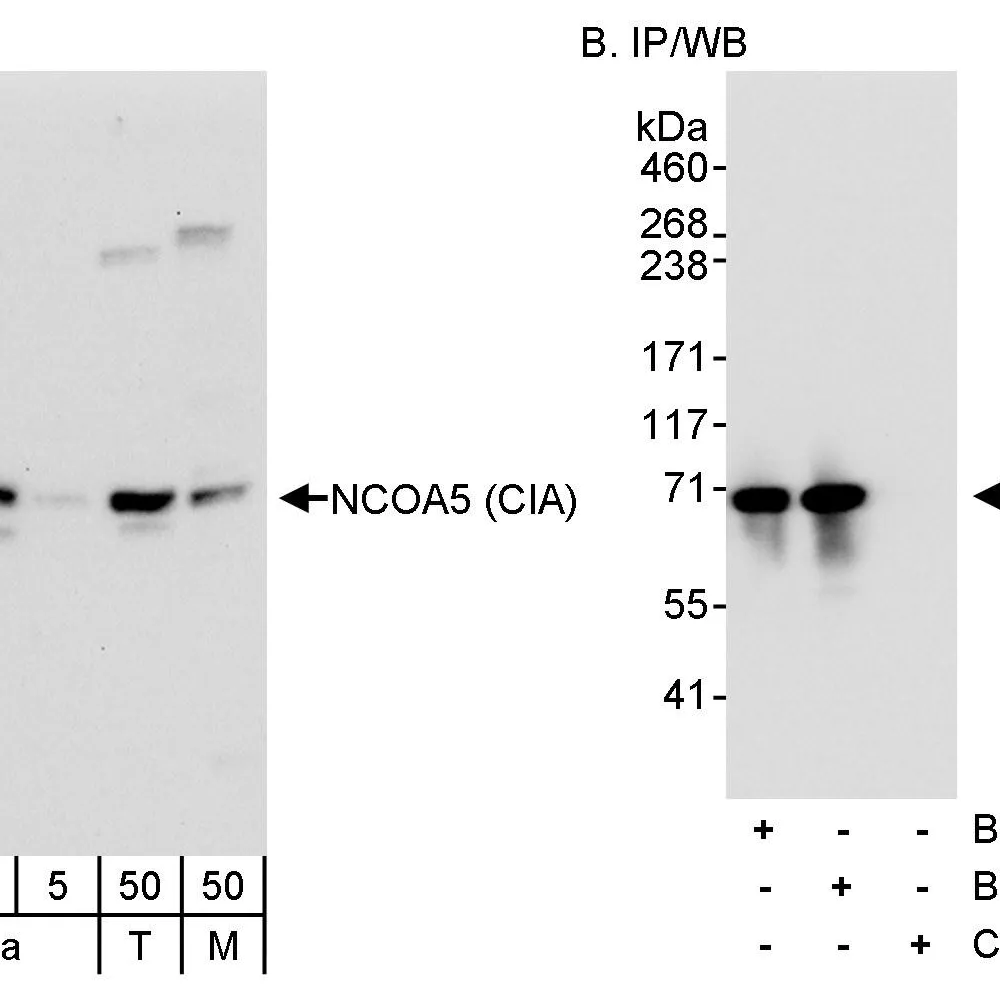 Rabbit anti-NCOA5/CIA Antibody, Affinity Purified