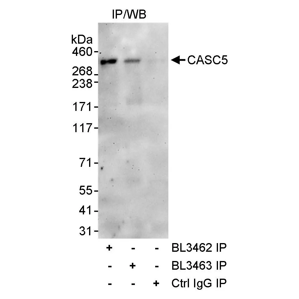 Rabbit anti-CASC5 Antibody, Affinity Purified
