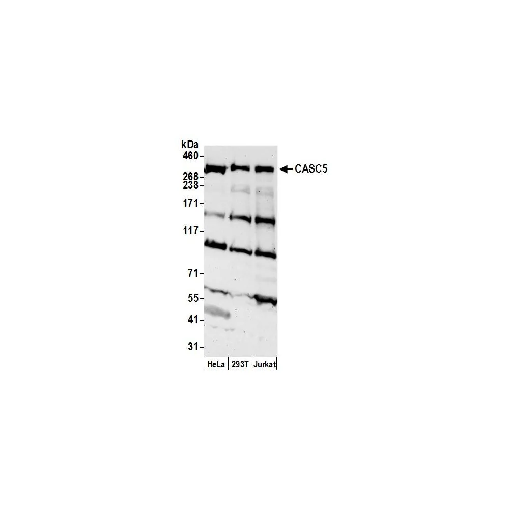 Rabbit anti-CASC5 Antibody, Affinity Purified