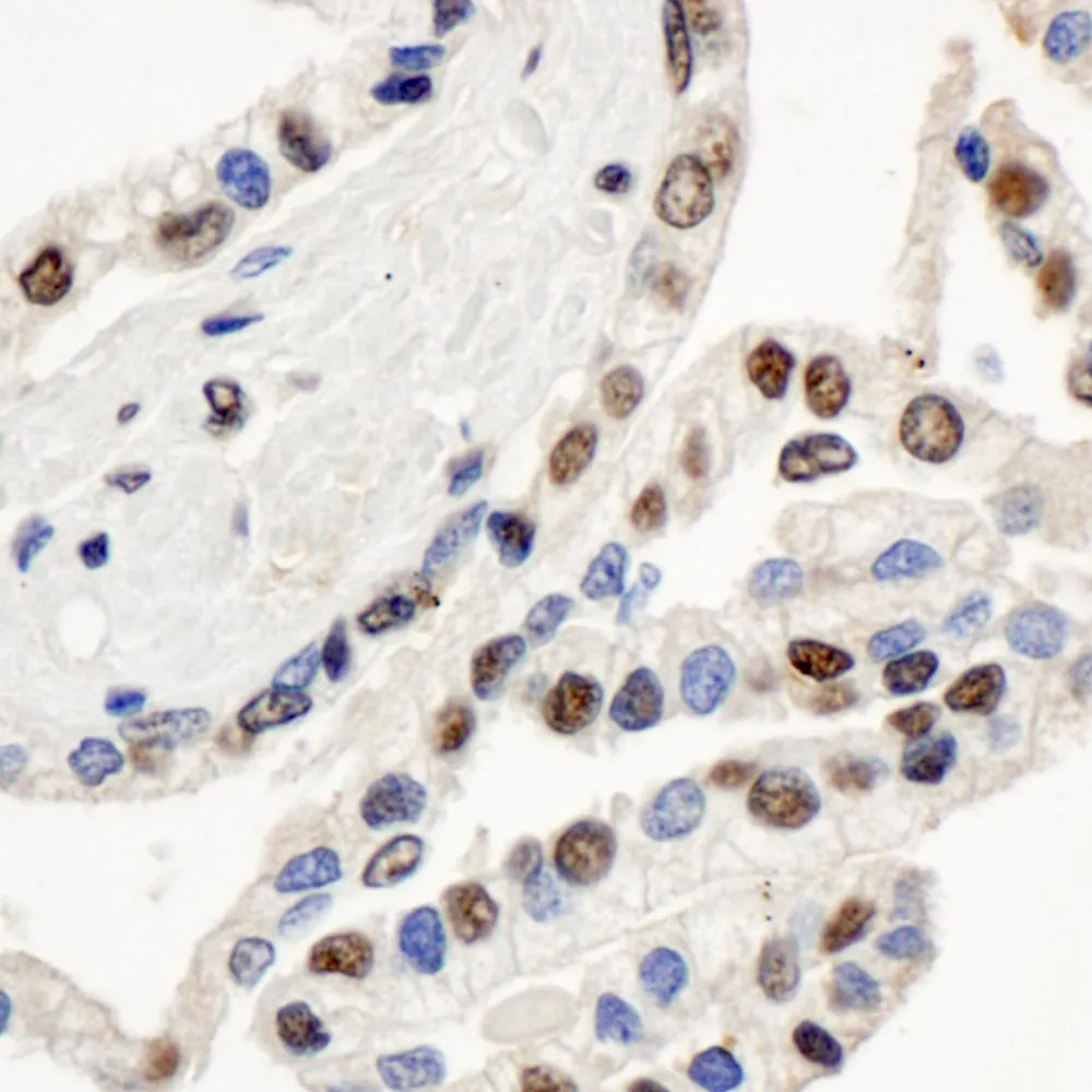 Rabbit anti-BAF57/SMARCE1 Antibody, Affinity Purified