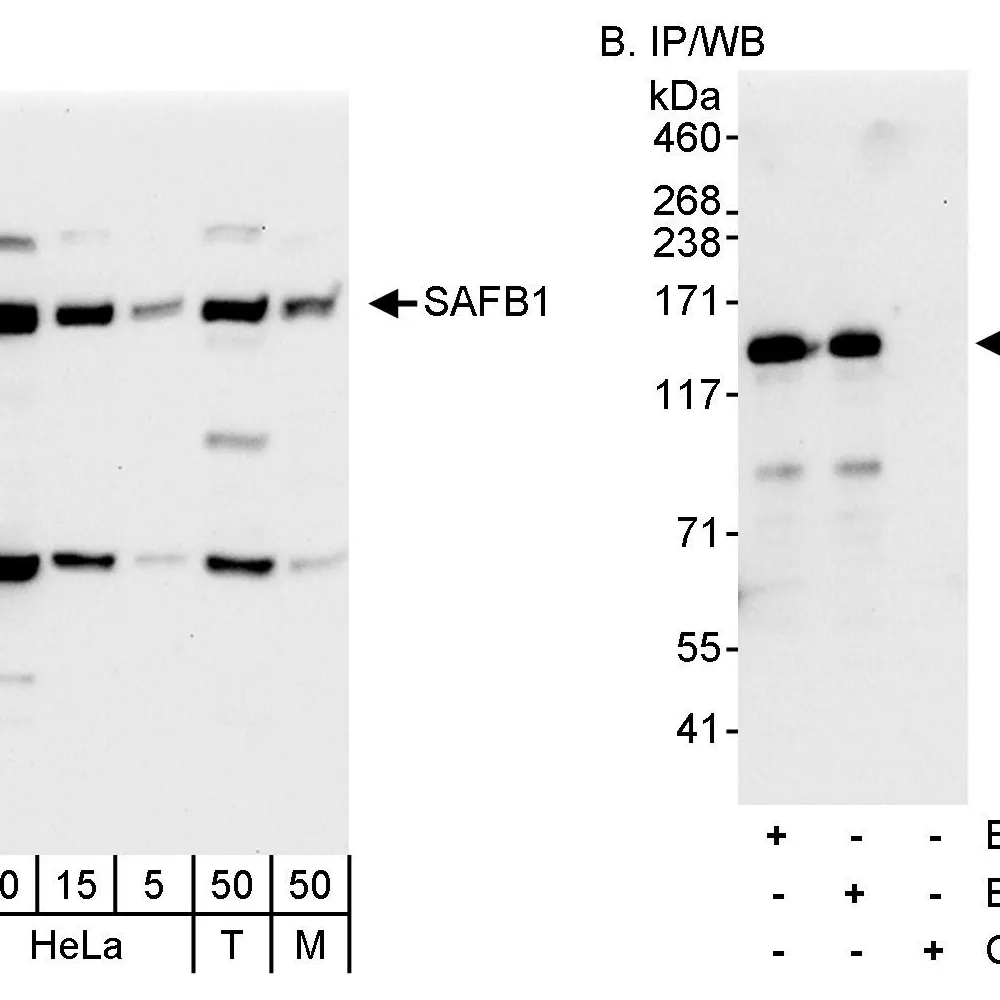 Rabbit anti-SAFB1 Antibody, Affinity Purified