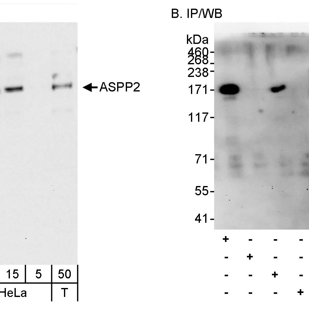 Rabbit anti-ASPP2 Antibody, Affinity Purified