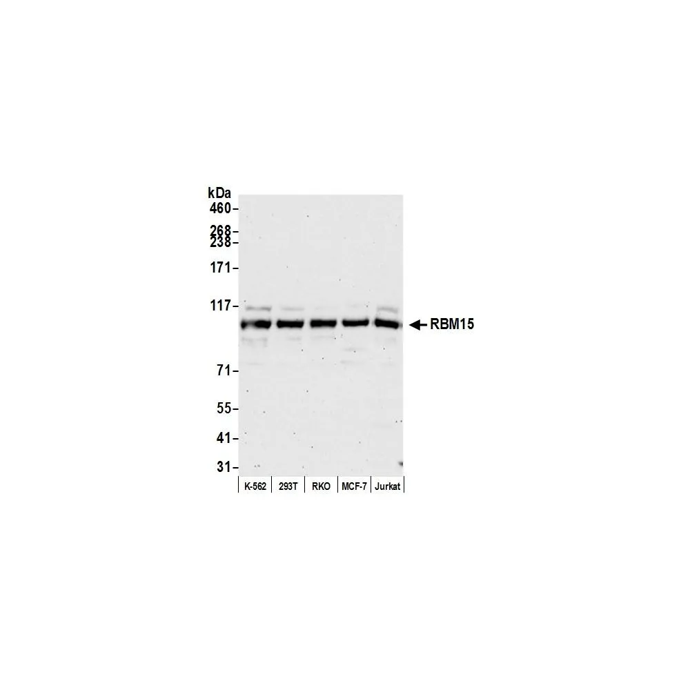 Rabbit anti-RBM15 Antibody, Affinity Purified