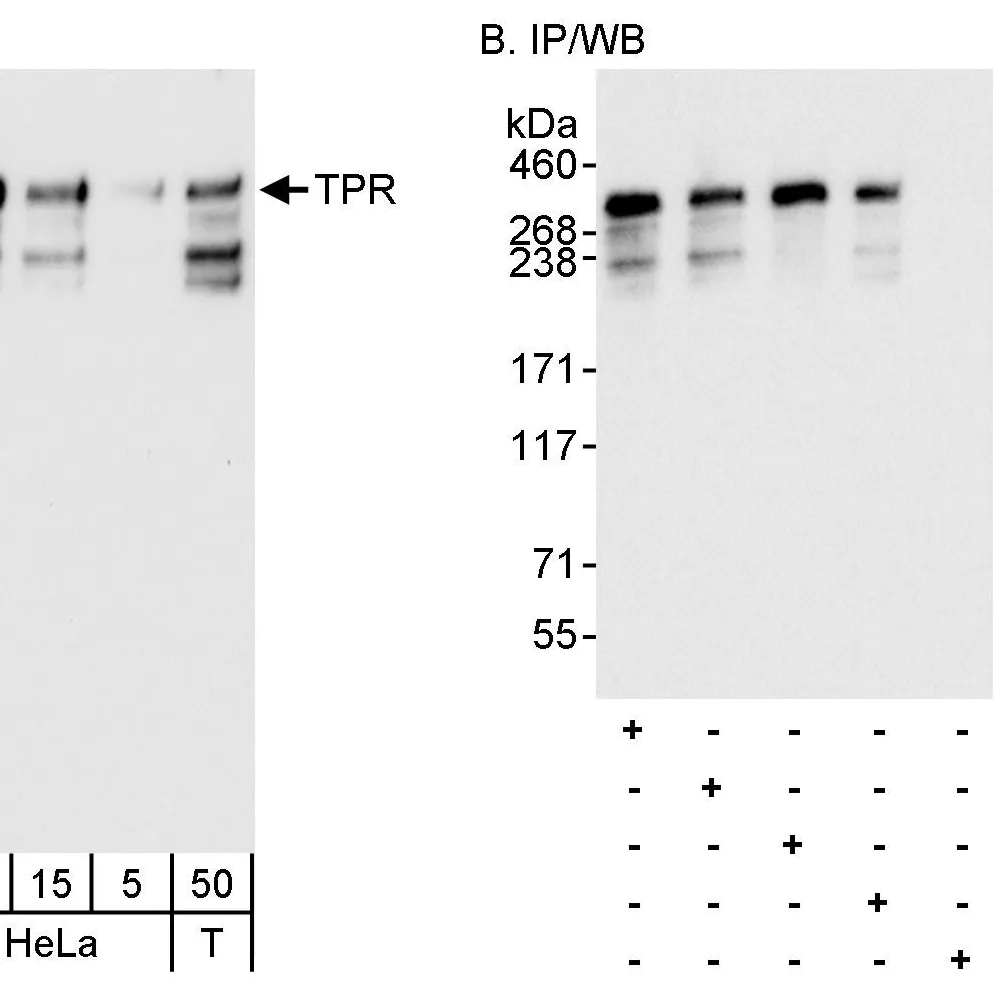 Rabbit anti-TPR Antibody, Affinity Purified