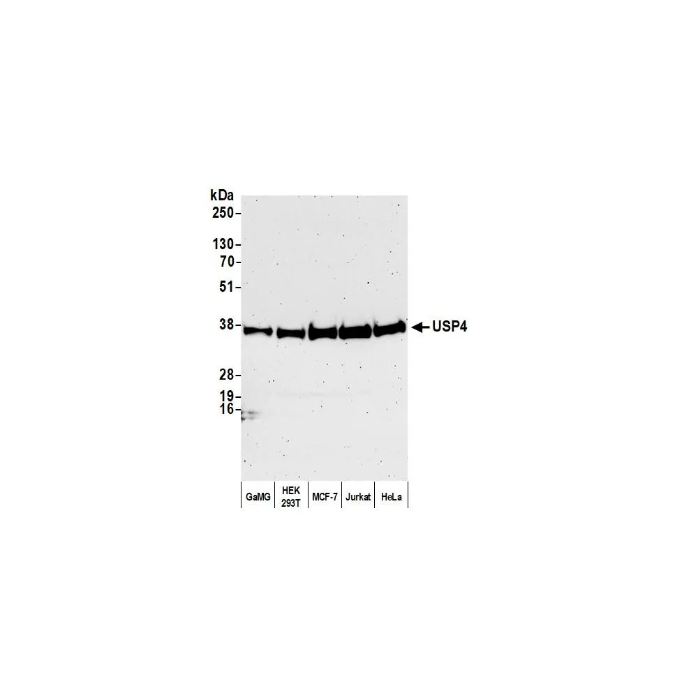 Rabbit anti-USP4 Antibody, Affinity Purified