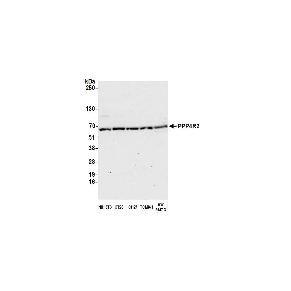 Rabbit anti-PPP4R2 Antibody, Affinity Purified