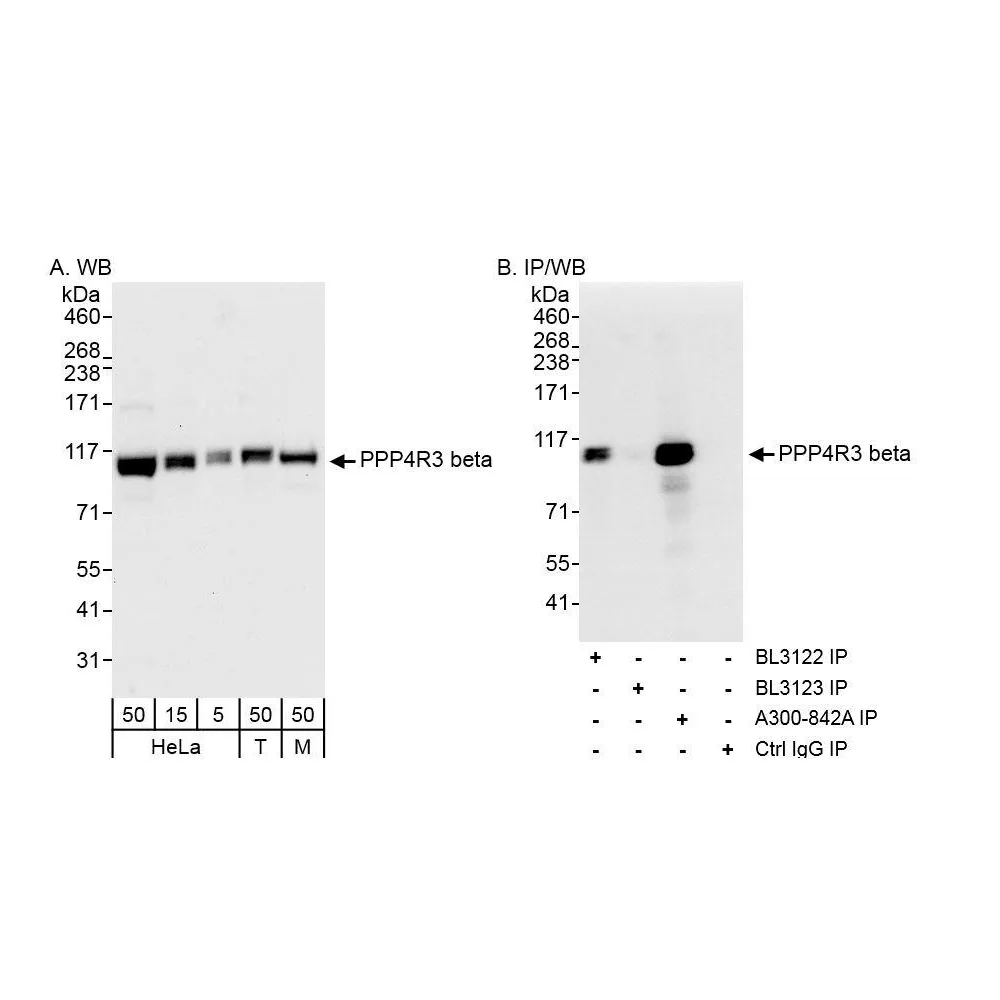 Rabbit anti-PPP4R3 Beta Antibody, Affinity Purified