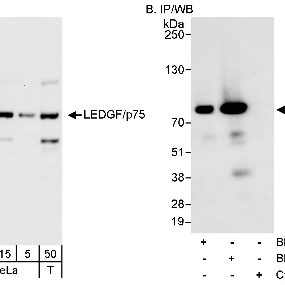Rabbit anti-LEDGF/p75 Antibody, Affinity Purified