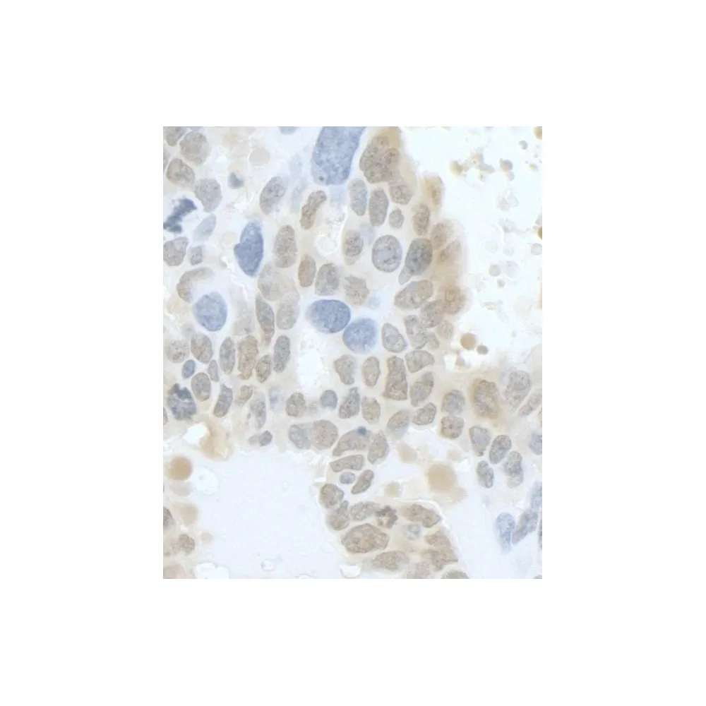 Rabbit anti-HURP/DLG7 Antibody, Affinity Purified