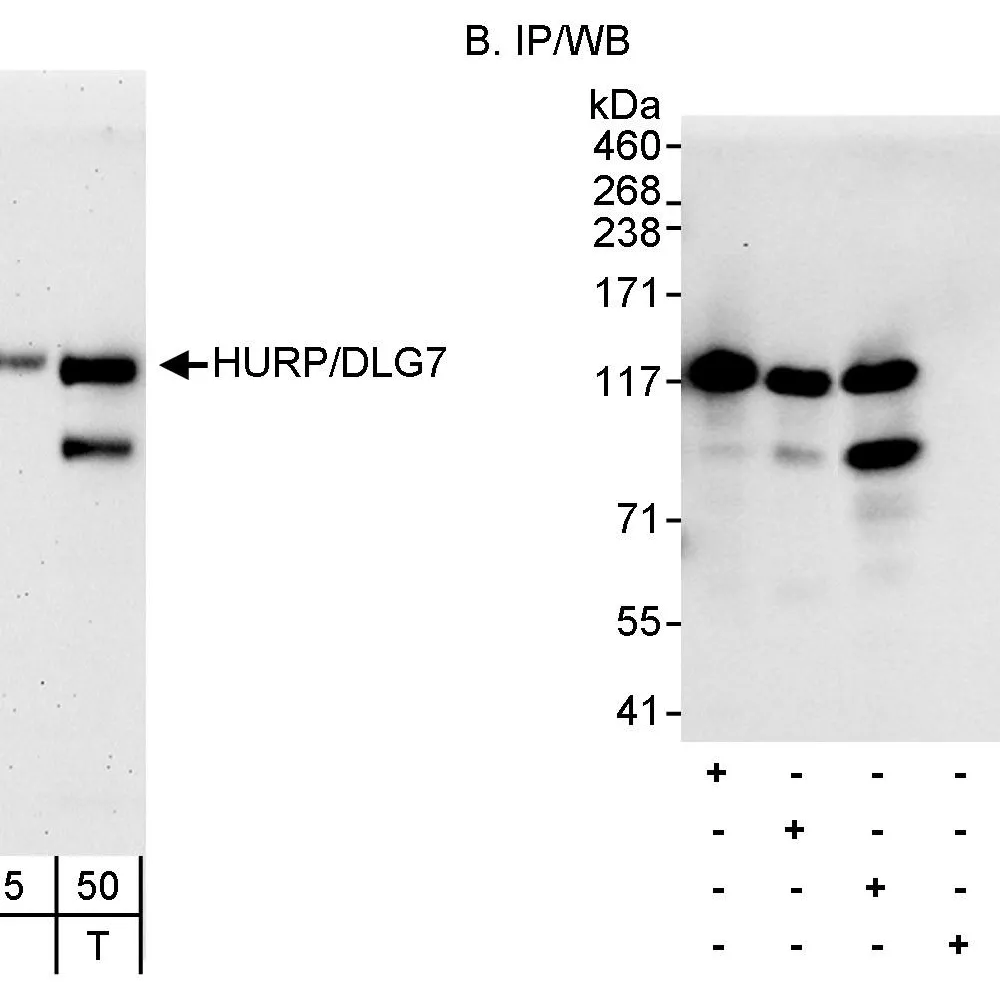 Rabbit anti-HURP/DLG7 Antibody, Affinity Purified