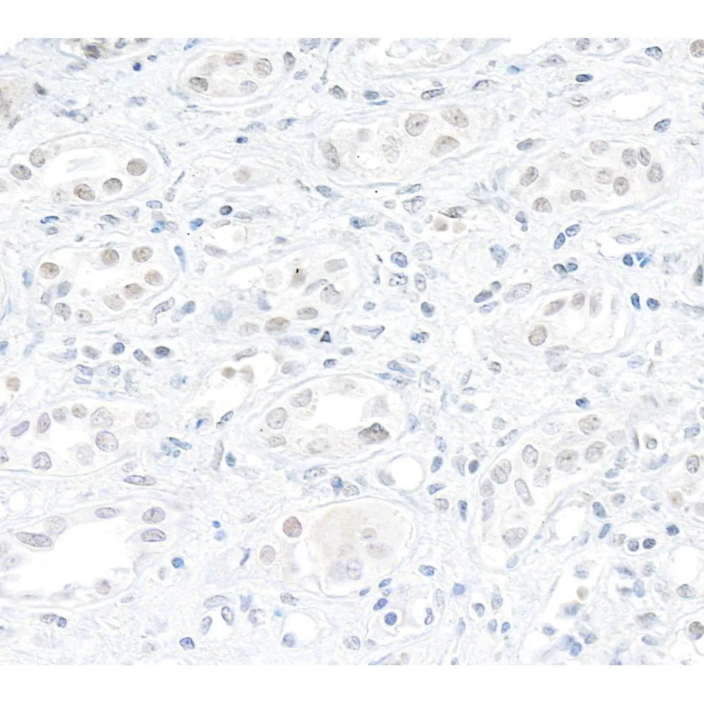 Rabbit anti-DHX9 Antibody, Affinity Purified