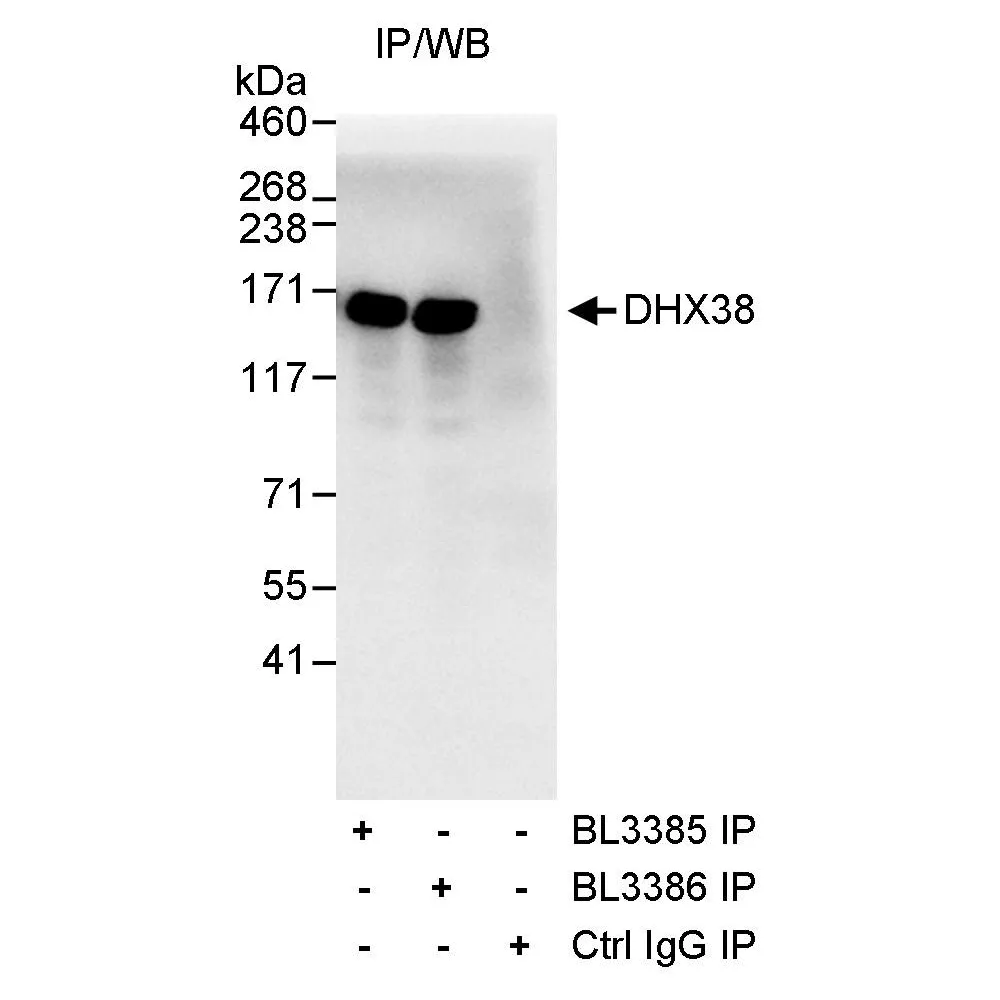 Rabbit anti-DHX38 Antibody, Affinity Purified