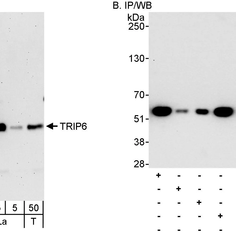 Rabbit anti-TRIP6 Antibody, Affinity Purified
