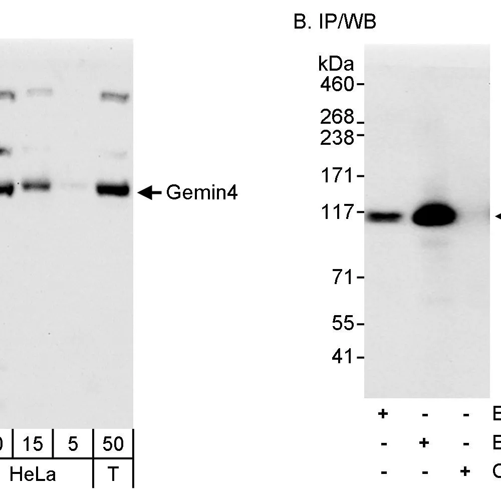 Rabbit anti-Gemin4 Antibody, Affinity Purified