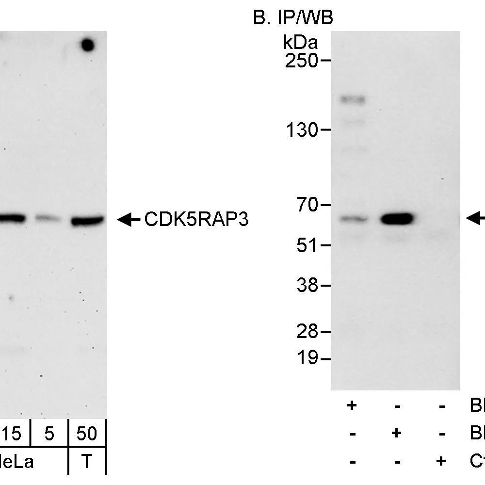 Rabbit anti-CDK5RAP3 Antibody, Affinity Purified