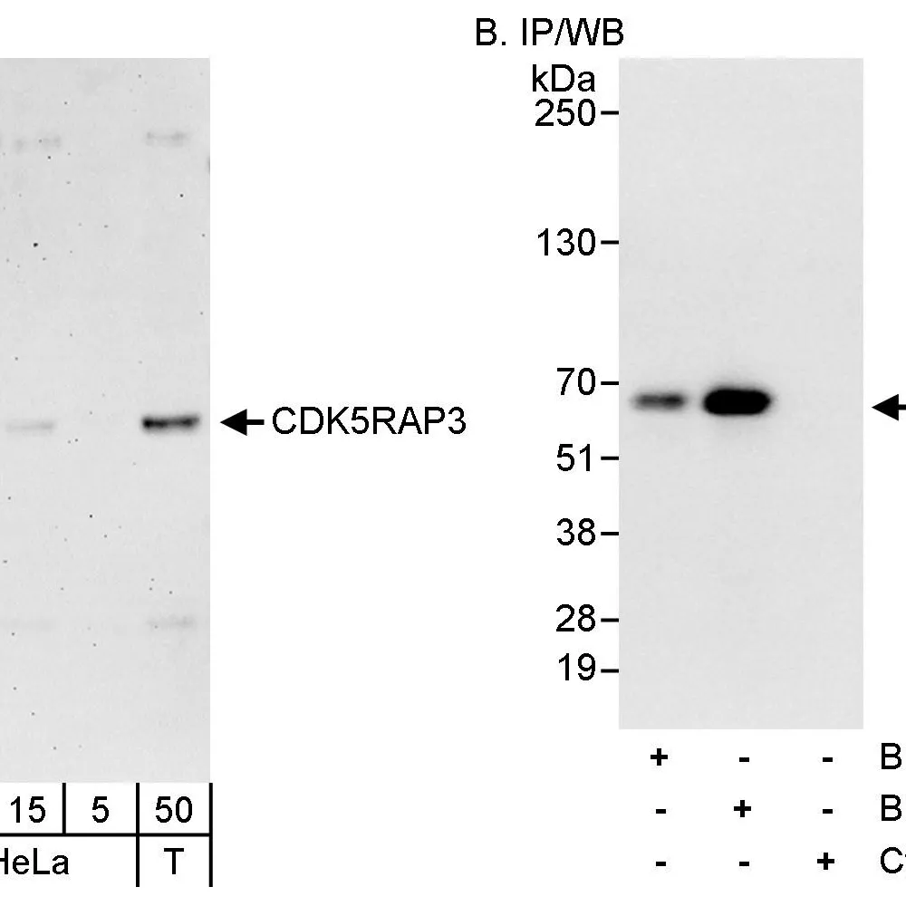Rabbit anti-CDK5RAP3 Antibody, Affinity Purified