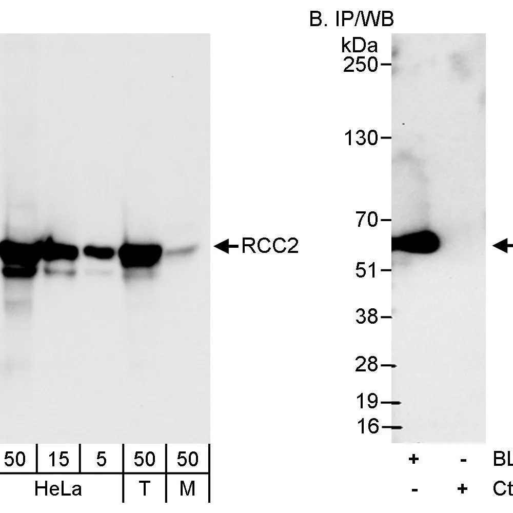 Rabbit anti-RCC2 Antibody, Affinity Purified