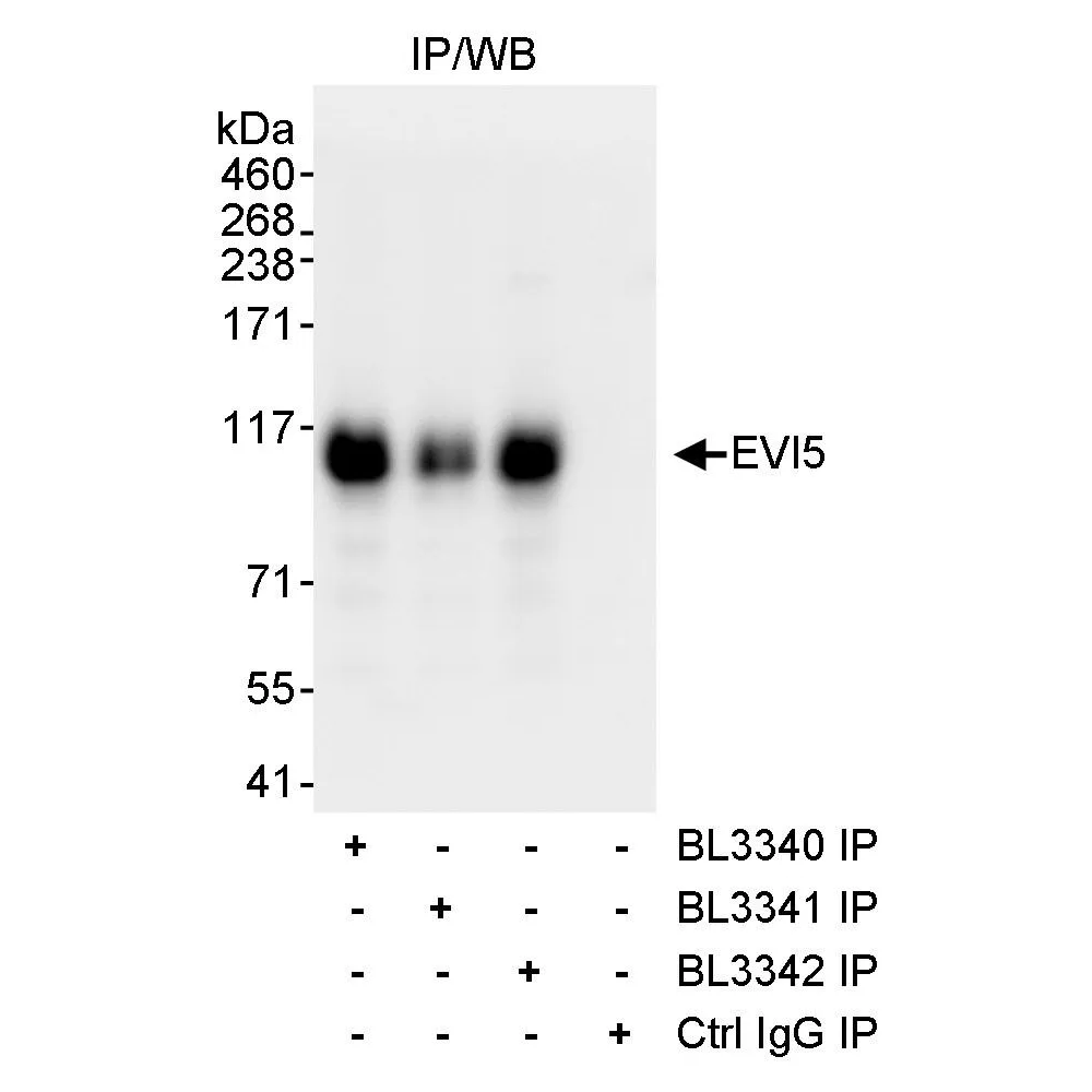 Rabbit anti-EVI5 Antibody, Affinity Purified