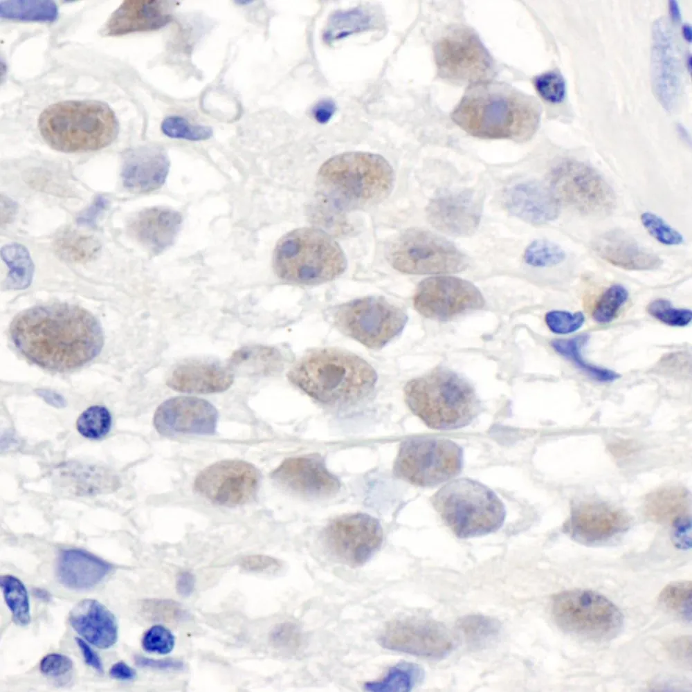 Rabbit anti-PELP1/MNAR Antibody, Affinity Purified