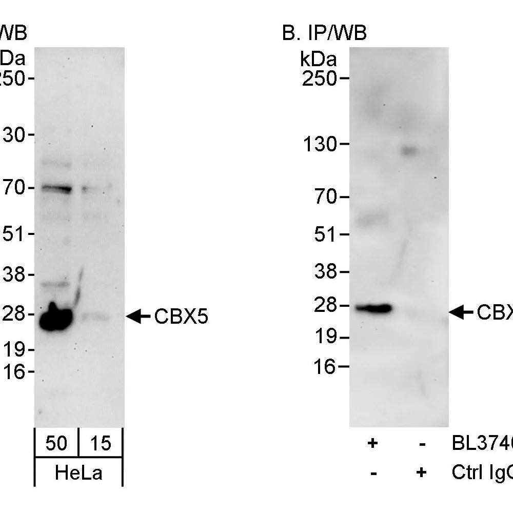 Rabbit anti-CBX5 Antibody, Affinity Purified