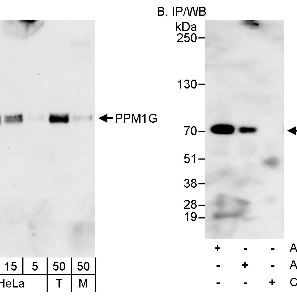Rabbit anti-PPM1G Antibody, Affinity Purified