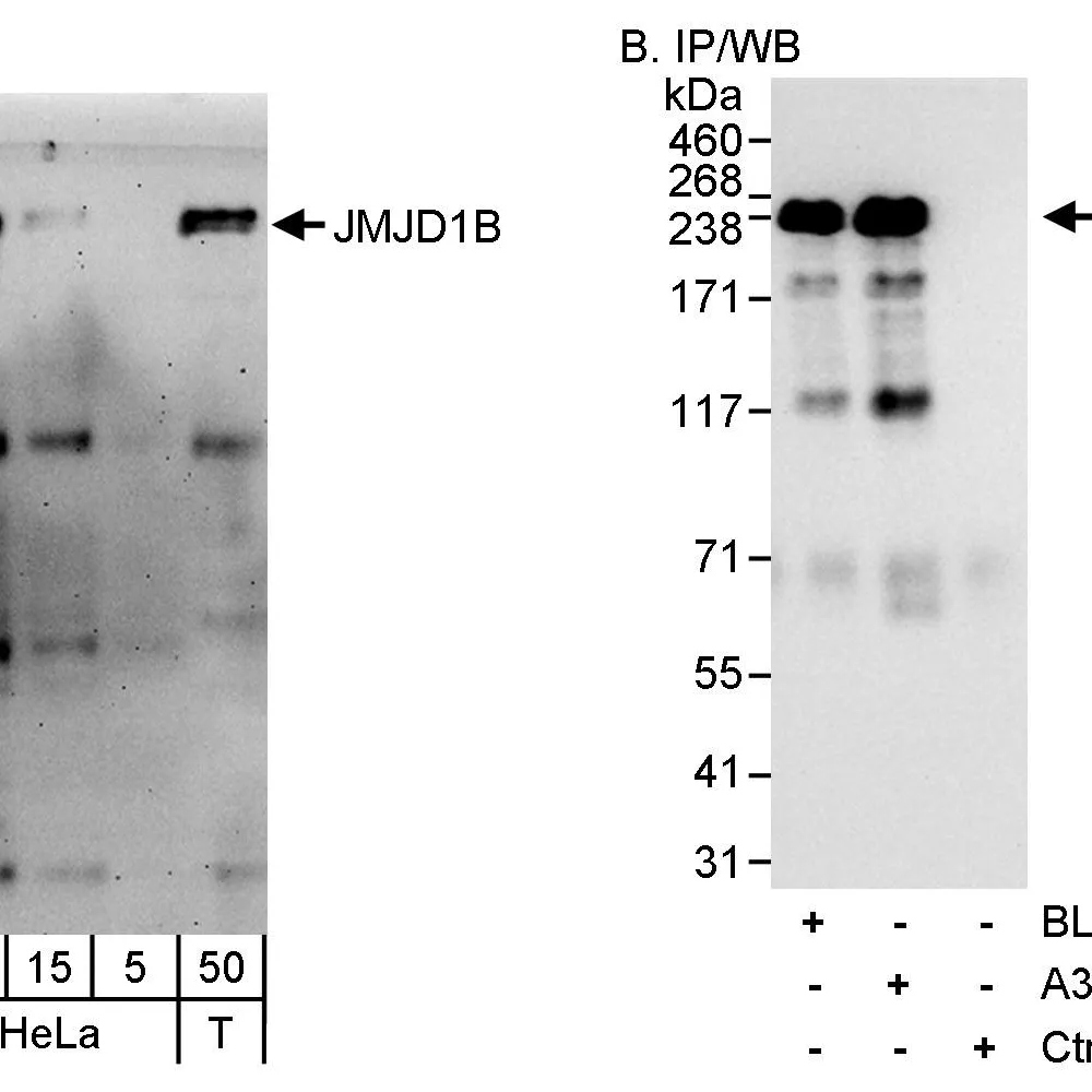 Rabbit anti-JMJD1B Antibody, Affinity Purified