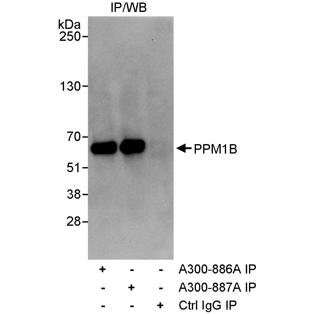 Rabbit anti-PPM1B Antibody, Affinity Purified
