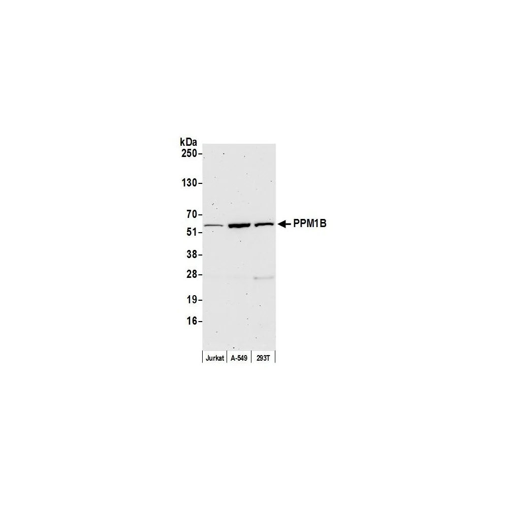 Rabbit anti-PPM1B Antibody, Affinity Purified