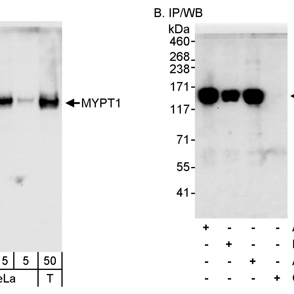 Rabbit anti-MYPT1 Antibody, Affinity Purified
