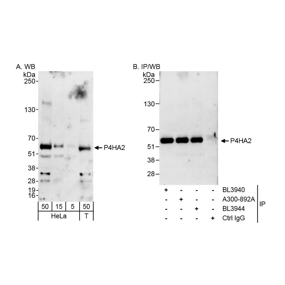 Rabbit anti-P4HA2 Antibody, Affinity Purified