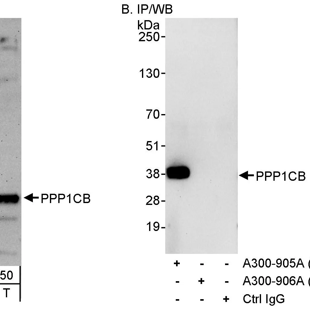 Rabbit anti-PPP1CB Antibody, Affinity Purified