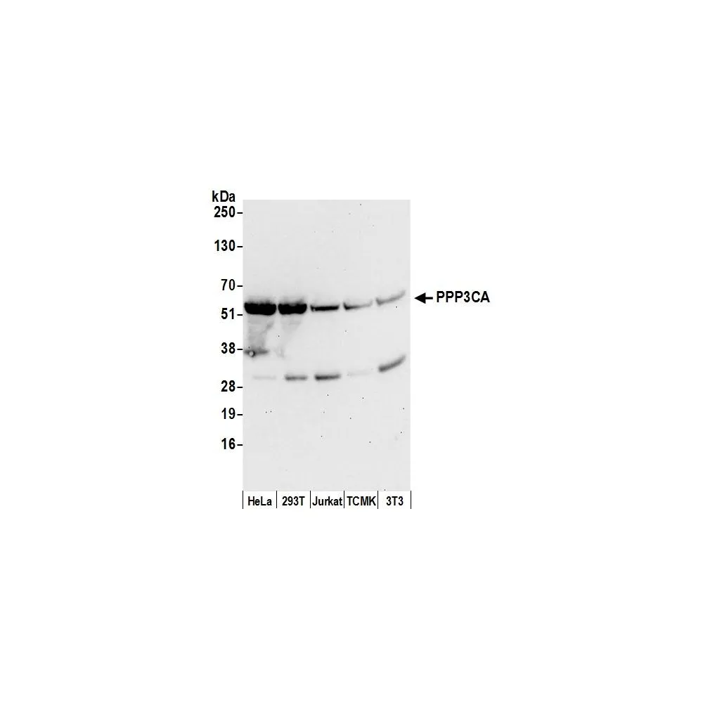 Rabbit anti-PPP3CA Antibody, Affinity Purified