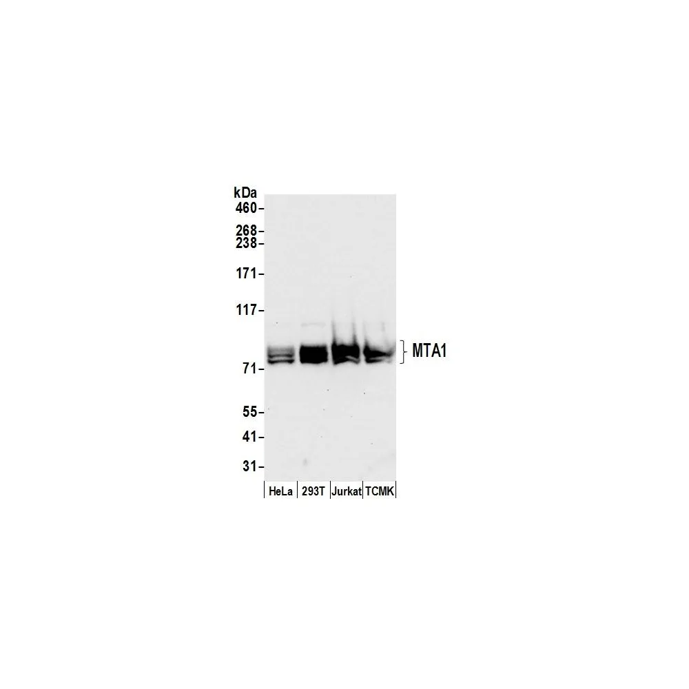 Rabbit anti-MTA1 Antibody, Affinity Purified