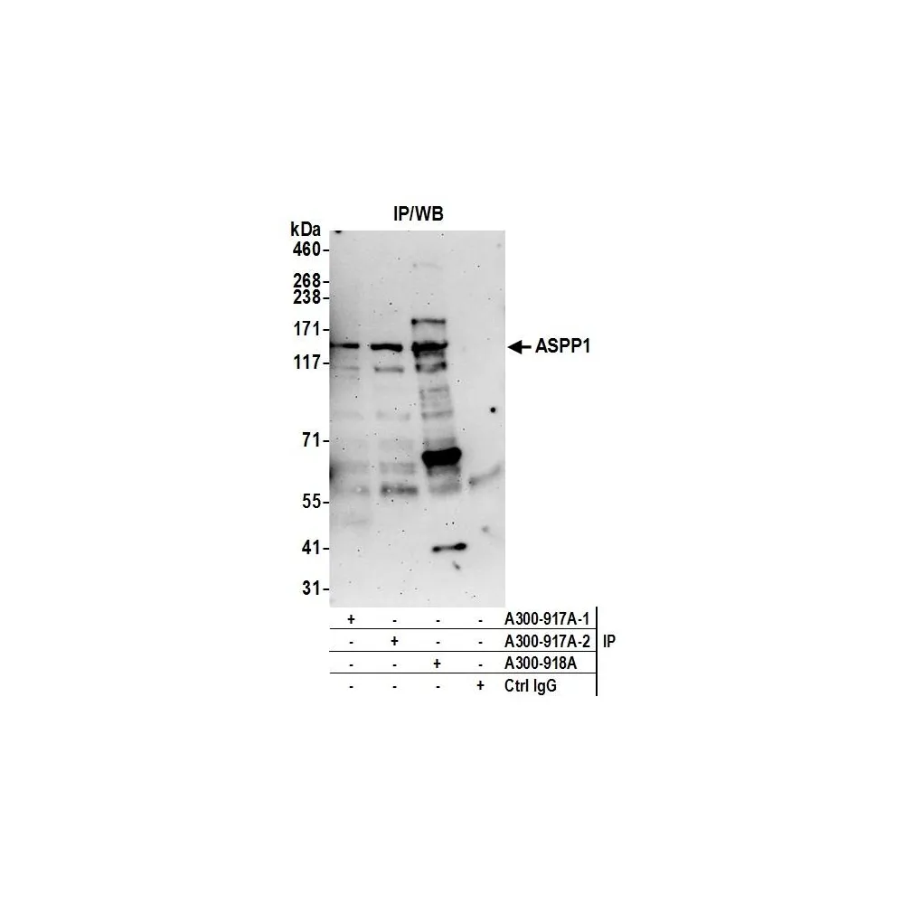 Rabbit anti-ASPP1 Antibody, Affinity Purified