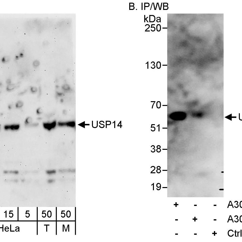 Rabbit anti-USP14 Antibody, Affinity Purified