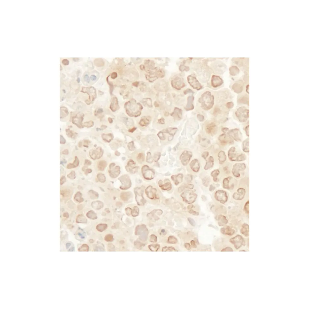 Rabbit anti-MCAK Antibody, Affinity Purified