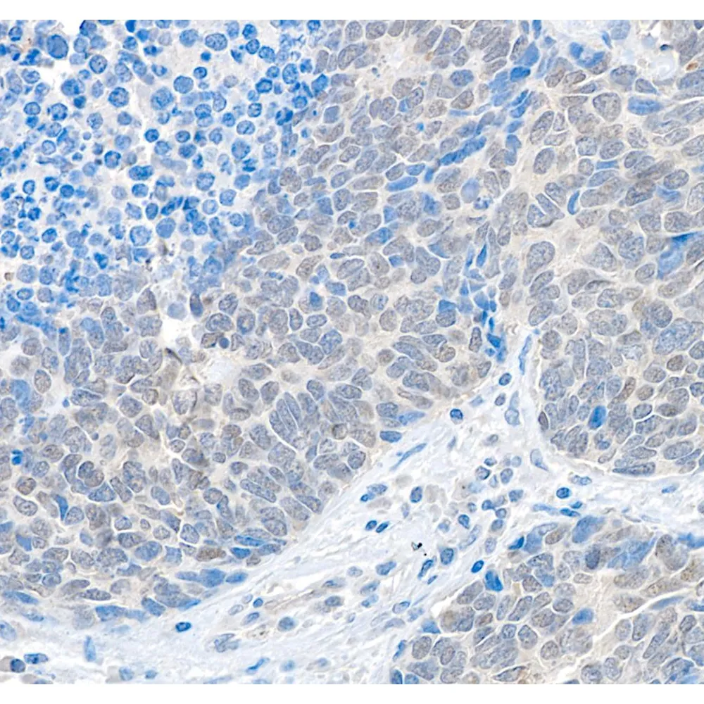 Rabbit anti-USP37 Antibody, Affinity Purified