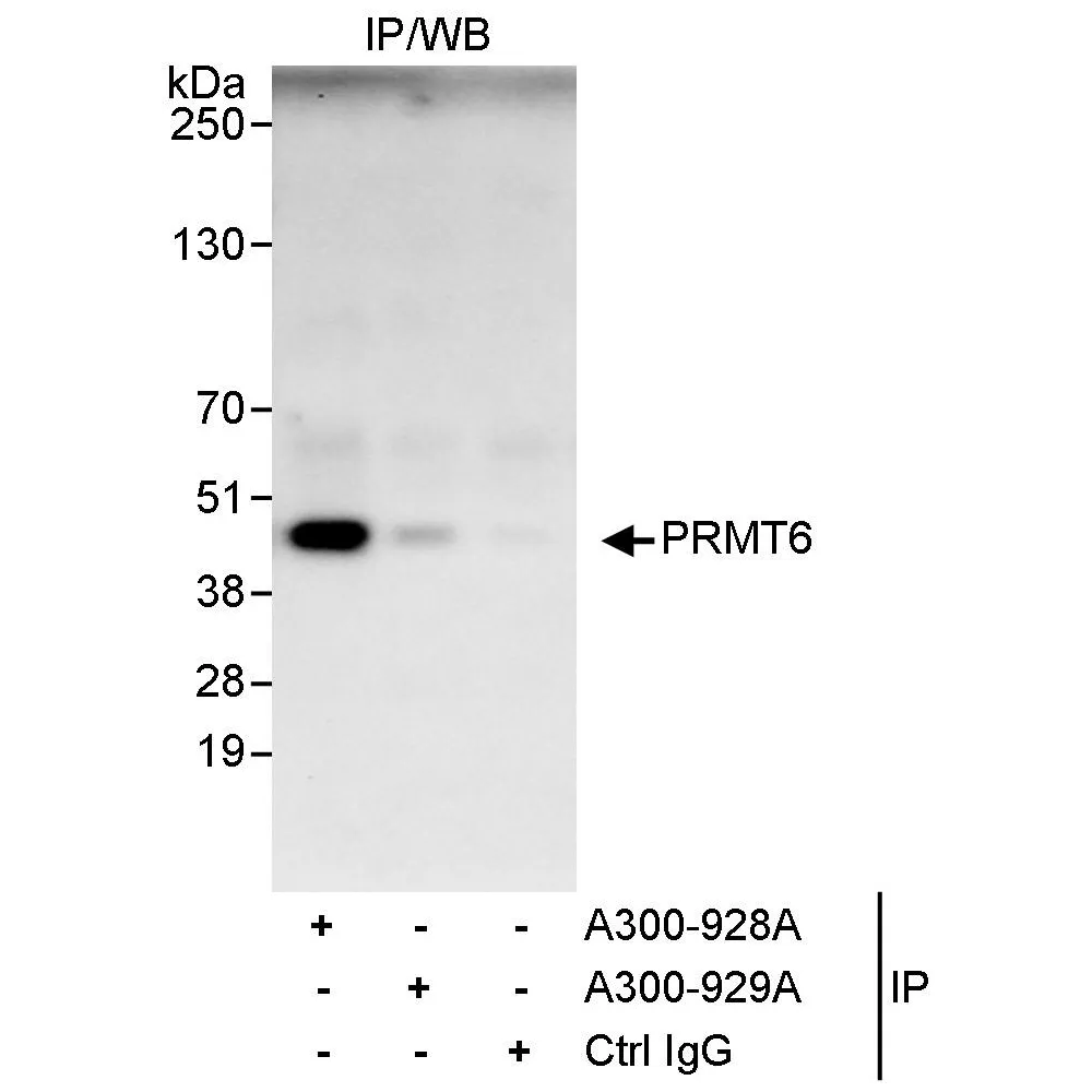 Rabbit anti-PRMT6 Antibody, Affinity Purified
